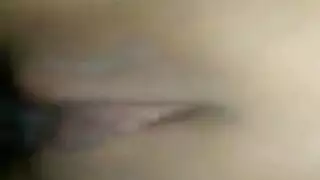 الشرج مشعرات دكتورالاسنان خجول